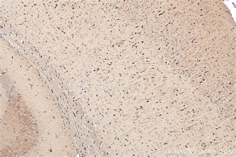 Calumenin antibody (17804-1-AP) | Proteintech