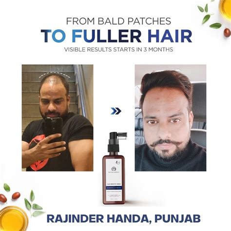 Hair Growth Tonic (3% REDENSYL & JOJOBA OIL) | Hair Thickener For Men ...