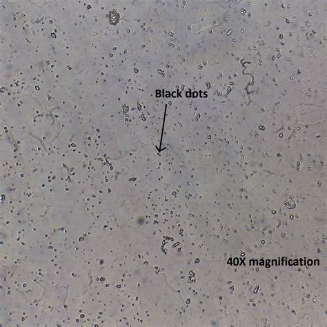 Black Specks Plastic