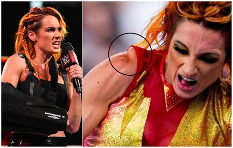 Becky Lynch New Look