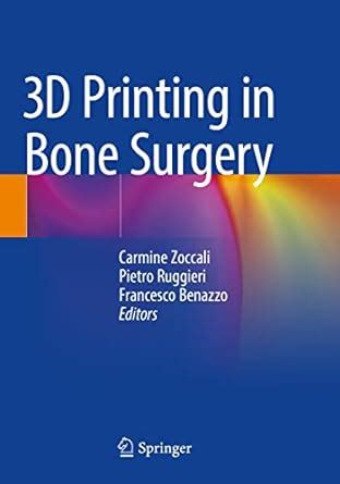 Buy 3D Printing in Bone Surgery Book Online at Low Prices in India | 3D ...