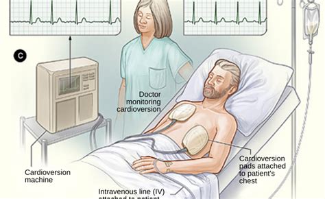 Image result for What Does Synchronized Cardioversion Do