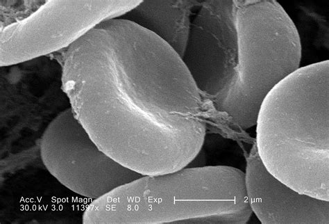 Free picture: closer look, details, exhibited, red, blood, cells