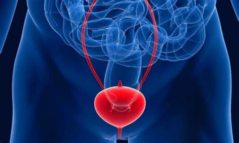 Childhood Gut and Urinary Disorders May Triple Risk of Interstitial ...