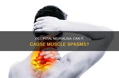 Occipital Neuralgia: Can It Cause Muscle Spasms? | CyVigor