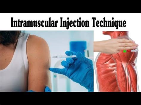 Image result for How to Do IM Injections