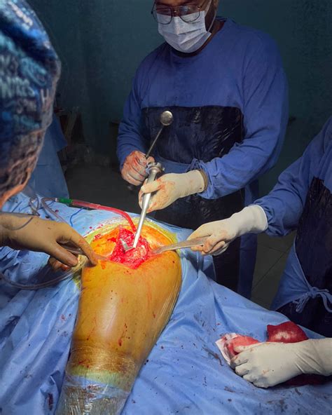 Hip replacement surgery in rudrapur Uttarakhand, Knee replacement ...