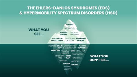 Hypermobile Ehlers-Danlos Syndrome (hEDS) symptoms & causes