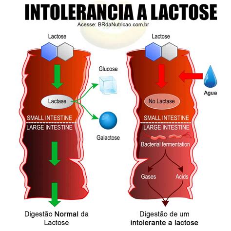 Intolerante A Lactose