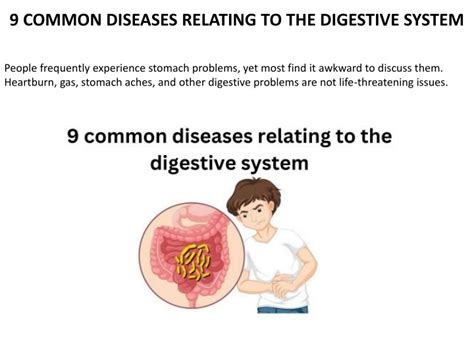 Digestive System Diseases 的图像结果