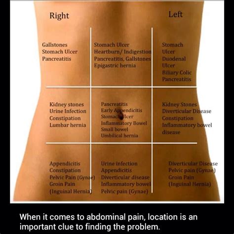 What Is A Sharp Pain In Left Side Of Stomach at Roberta Hackett blog