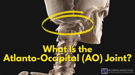 What Is the Atlanto-Occipital (AO) Joint - Centeno-Schultz