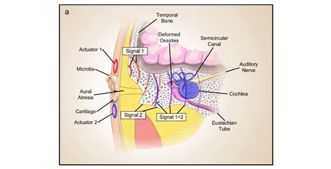 Image result for Thyroid Disease Classification Using Meachine Learning Algorithms