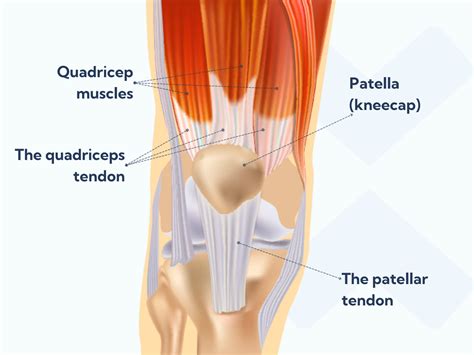 Patellar tendonitis: The comprehensive guide all runners need to read