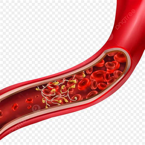 Blood Clots Clipart PNG Images, Human Blood Vessel Medical Vein Blood ...