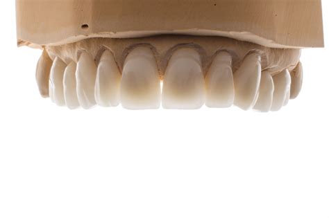 Zirconia Crown | Zirconia Dental Implant | Pindan Dental Lab