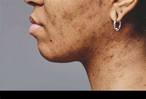 Image result for How to Link JavaScript In HTML