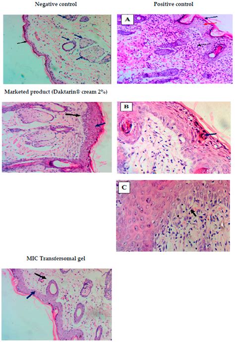 Design, Optimization and Characterization of a Transfersomal Gel Using ...