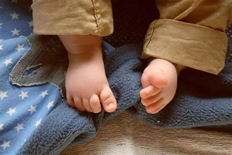 专家在线丨宝宝是不是“内八字”脚？看完这个你就全明白了！