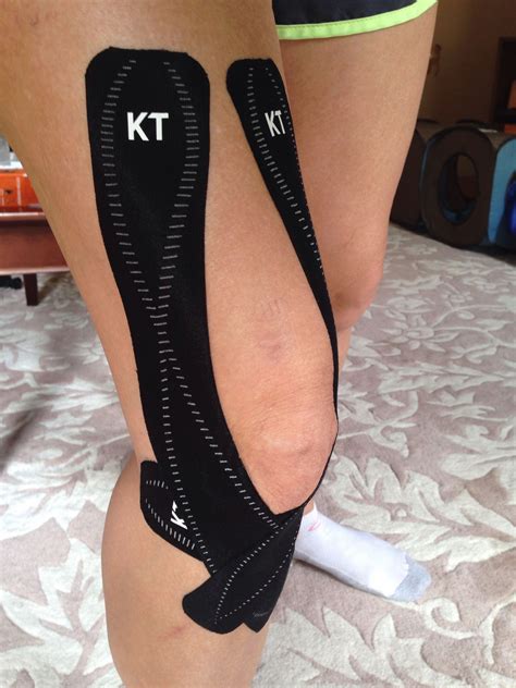 Quadriceps Tendonitis Taping And Bracing at Fletcher Luke blog