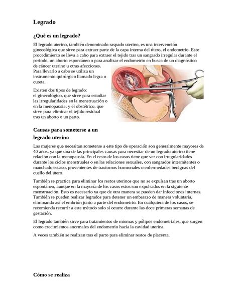 Que Es Un Legrado