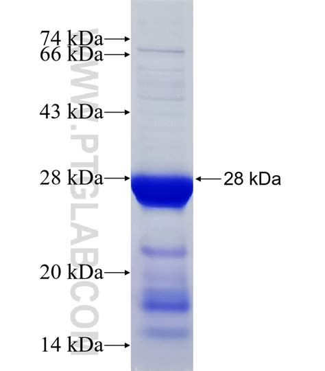 RIPK1 Fusion Protein Ag31943 | Proteintech