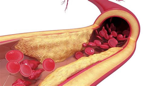 Interconnectivity of whole arterial system combining peripheral ...