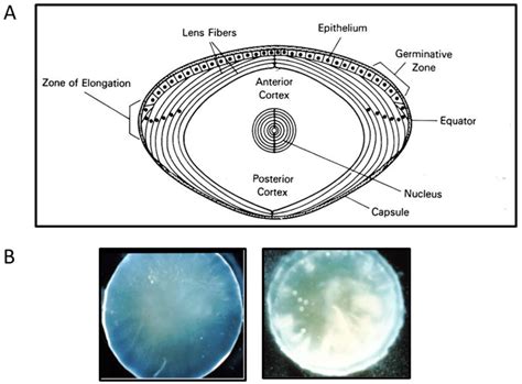 Glutathione and Glutaredoxin in Redox Regulation and Cell Signaling of ...