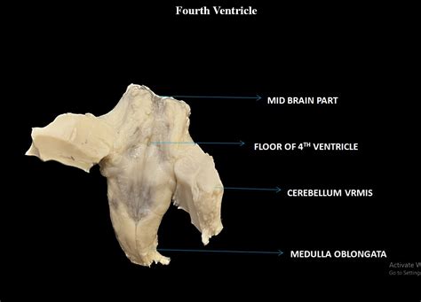 Fourth Ventricle | NAMO Medical Education & Research Institute