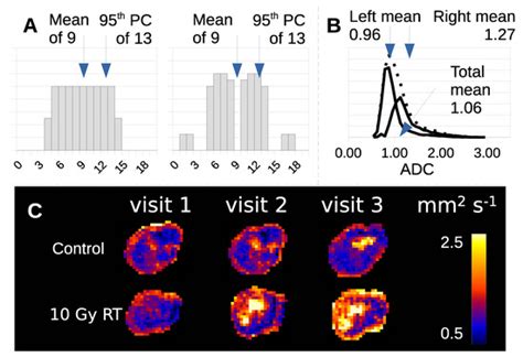 Cancers | Special Issue : Oncology: State-of-the-Art Research in UK