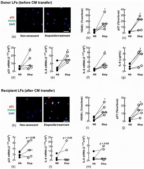 A Senescence Bystander Effect in Human Lung Fibroblasts