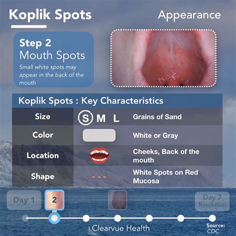 Image result for Machine Learning Flow Graphs