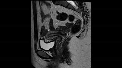 BIR Quiz of the Week