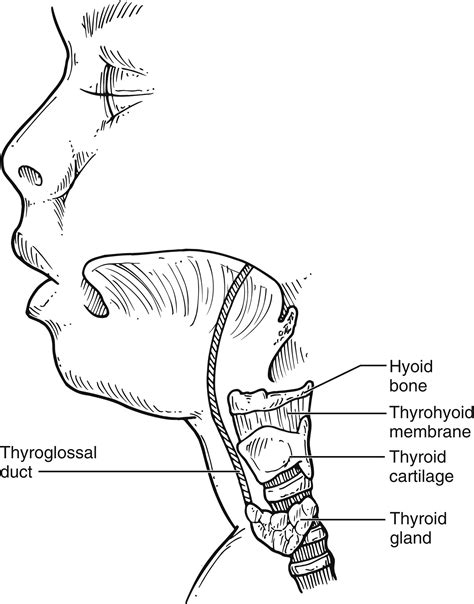 Thyroglossal duct cyst: Operative technique - Operative Techniques in Otolaryngology-Head and ...