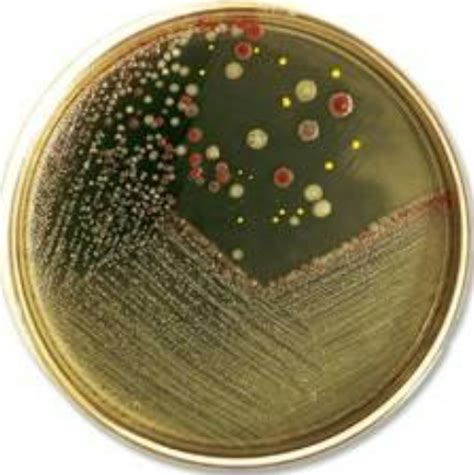 Image result for Pathogenicity of Microorganisms
