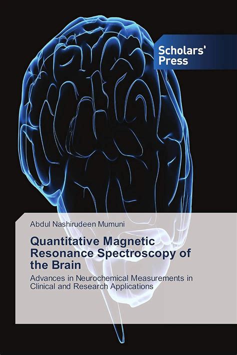Quantitative Magnetic Resonance Spectroscopy of the Brain : Amazon.in ...