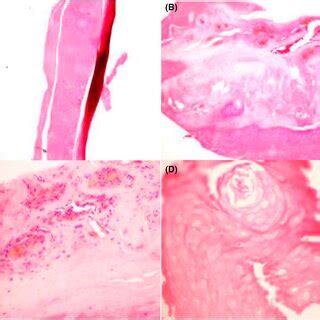 Microscopy images of tissue samples. (A) Microscopy image of M1 sample,... | Download Scientific ...