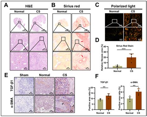 Metformin Attenuates TGF-β1-Induced Fibrosis in Salivary Gland: A ...