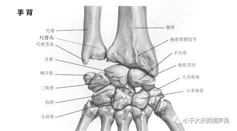 Image result for Difference in Difference Approach Example Diagram
