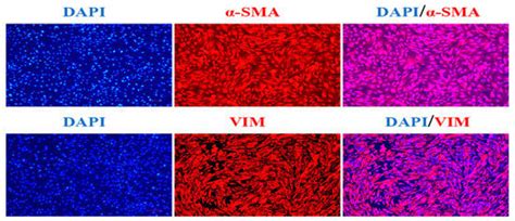 CRABP2 Promotes the Proliferation of Dermal Papilla Cells via the Wnt/β ...