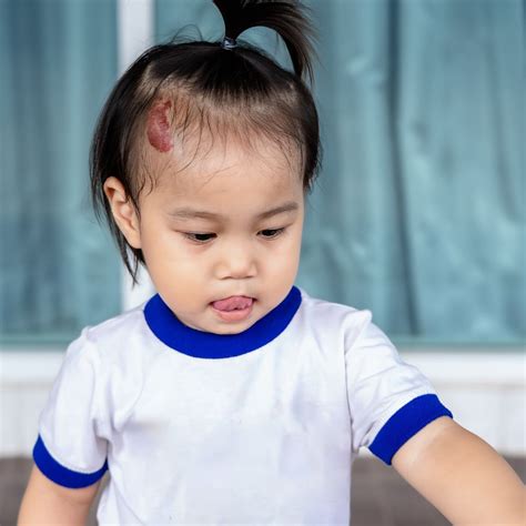 Strawberry Birthmark: spiritual meaning - Awakening State