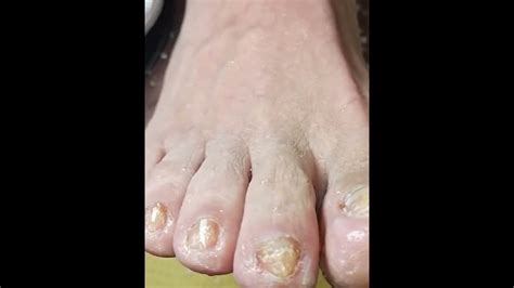 Image result for Clean Toe Nails