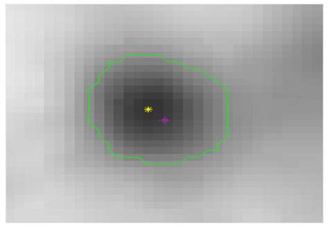 Intelligent Labeling of Tumor Lesions Based on Positron Emission ...