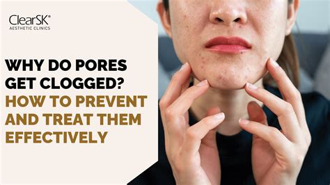 Why Do Pores Get Clogged? How to Prevent and Treat Clogged Pores ...