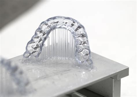 Occlusal guards — Paramount Dental Studio