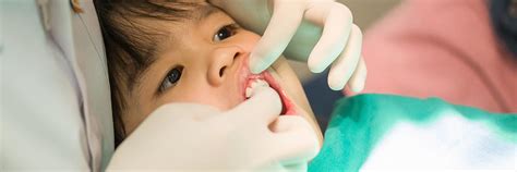 Root Canal Treatment in South Kolkata | Root Canal Treatment for Kids