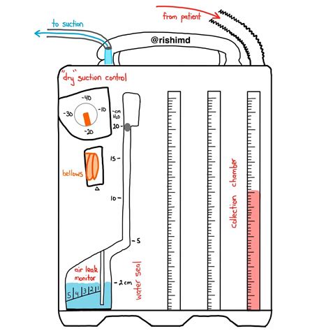 Normal Chest Tube Drainage