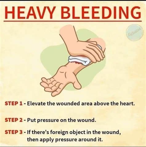 First Aid Heavy Bleeding 的图像结果