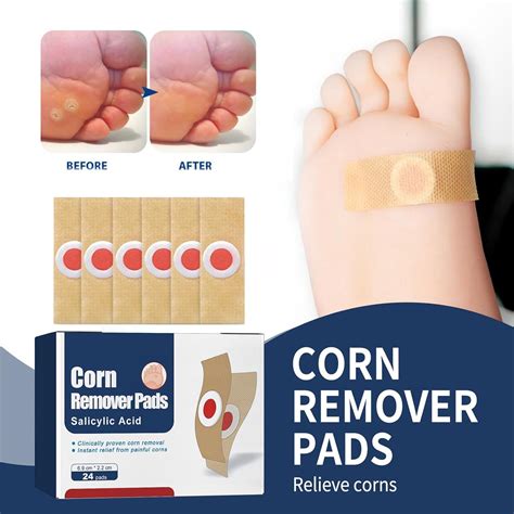 Foot Corn Remover Pads - 24 Pcs Corn Removal Plasters for Feet & Toe ...