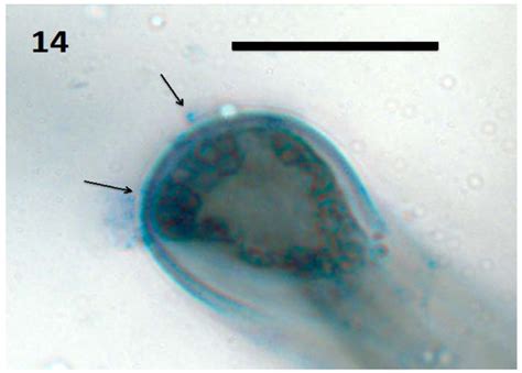 Rhizophagy Cycle: An Oxidative Process in Plants for Nutrient ...
